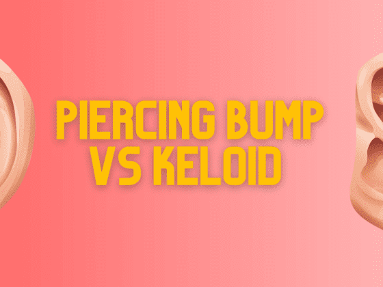 Piercing Bump Vs Keloid