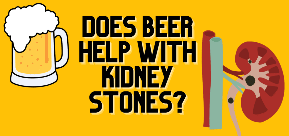 Does Beer Help With Kidney Stones