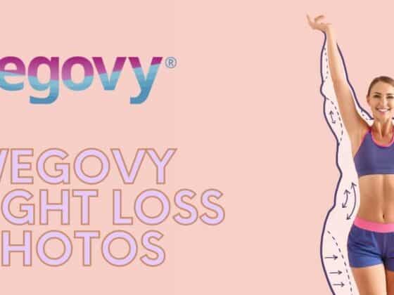 Wegovy Weight Loss Before And After Pictures