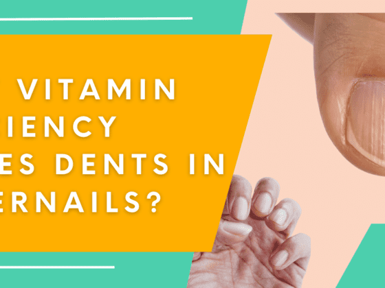 What Vitamin Deficiency Causes Dents In Fingernails