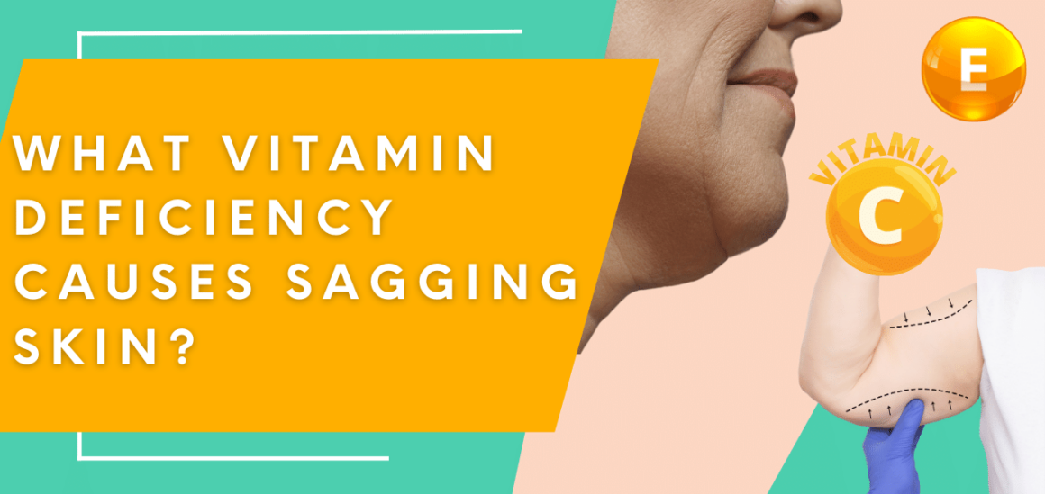 What Vitamin Deficiency Causes Sagging Skin